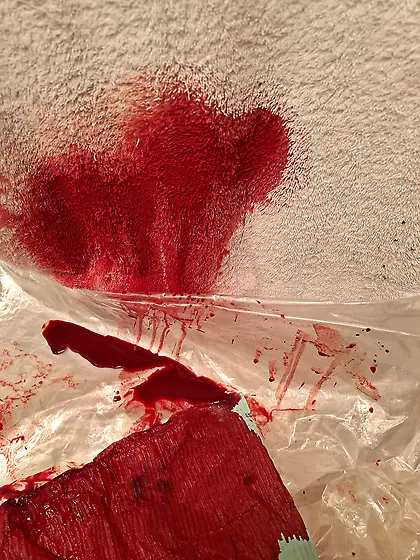 I impaled my cockhead with 18G needle the result