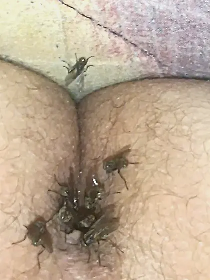 Flies on my anus in the village.  06. 2025
