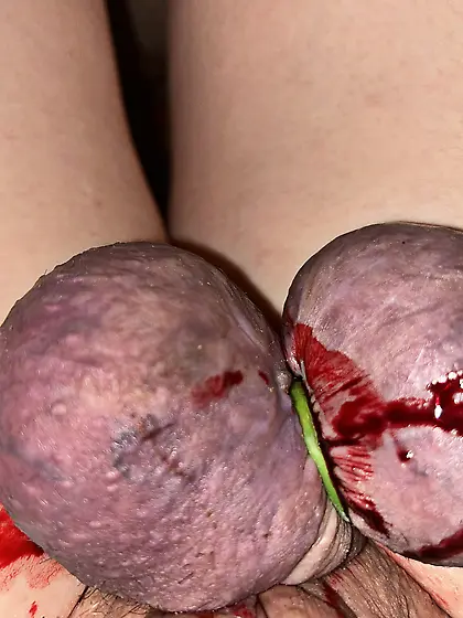 My cock and balls being prepared for cutting away
