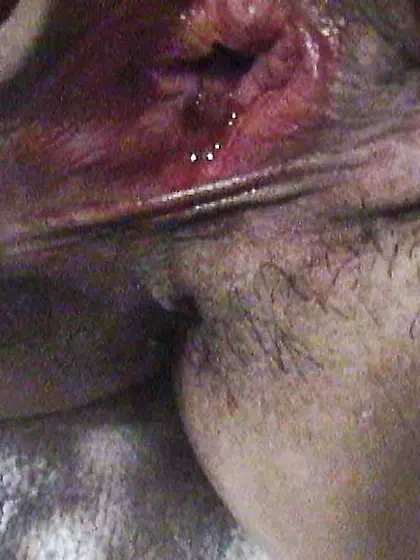 Ebiimo into har cunny